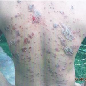 ٻ 1 ࢵѧѴͧѺҫɨҡçҹҧ 繼蹺ᴧ ѹҧ